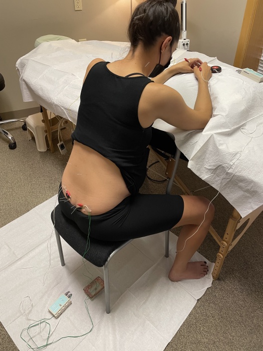 Pregnant person sitting in chair, leaning against massage table with acupuncture needles in. They al