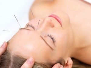 a woman laying down with acupuncture needles in her nose, eyebrow, cheek and forehead